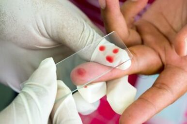 Diagnóstico de dolor en las articulaciones de los dedos