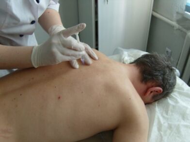 Inyecciones intraarticulares de condroprotectores para la osteocondrosis torácica.